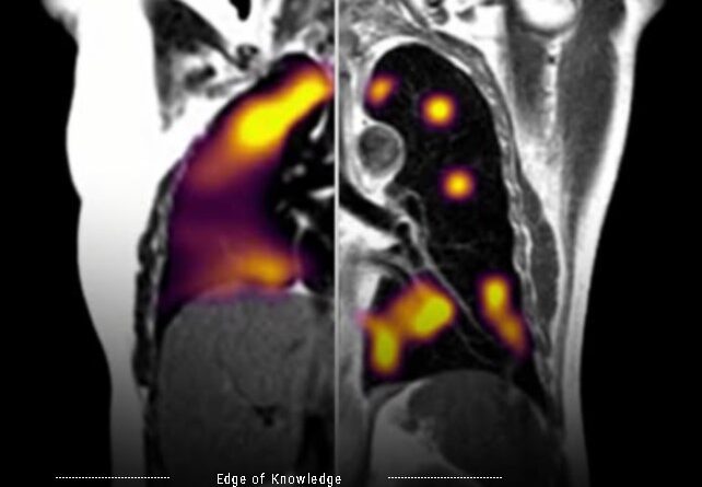 Persistent COVID-19: Stunning Two-Year Infection Sparks Urgent Alarm