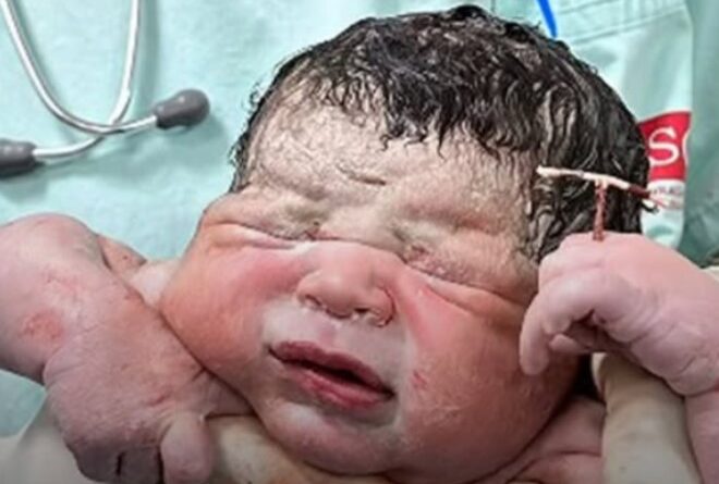 Newborn Baby’s Stunning Victory Holding IUD That Failed